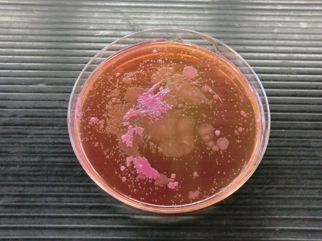 性病検査の意義：何がわかり、なぜ重要なのか